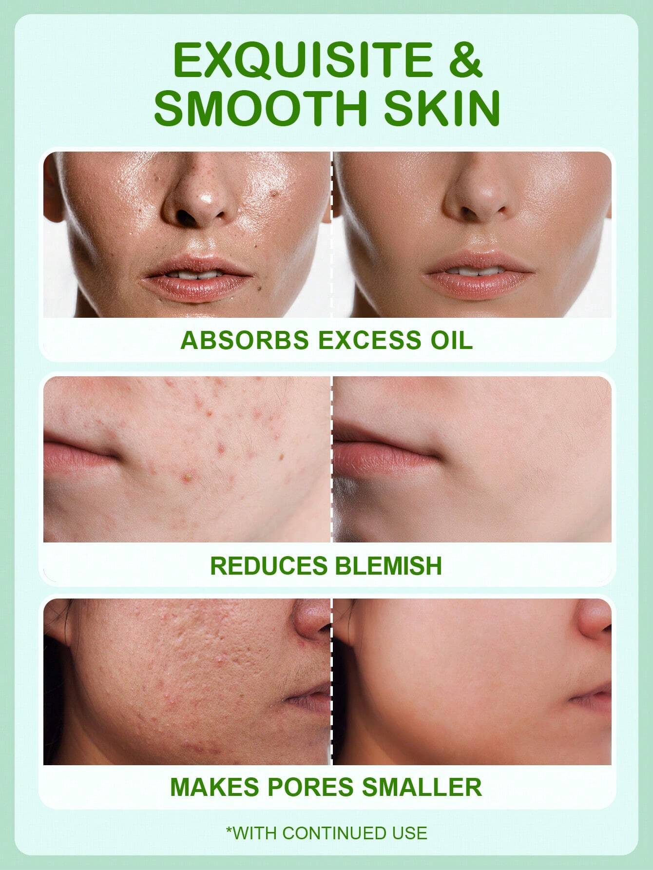 Slow Sunday Salicylic Acid Anti-Blemish Gel