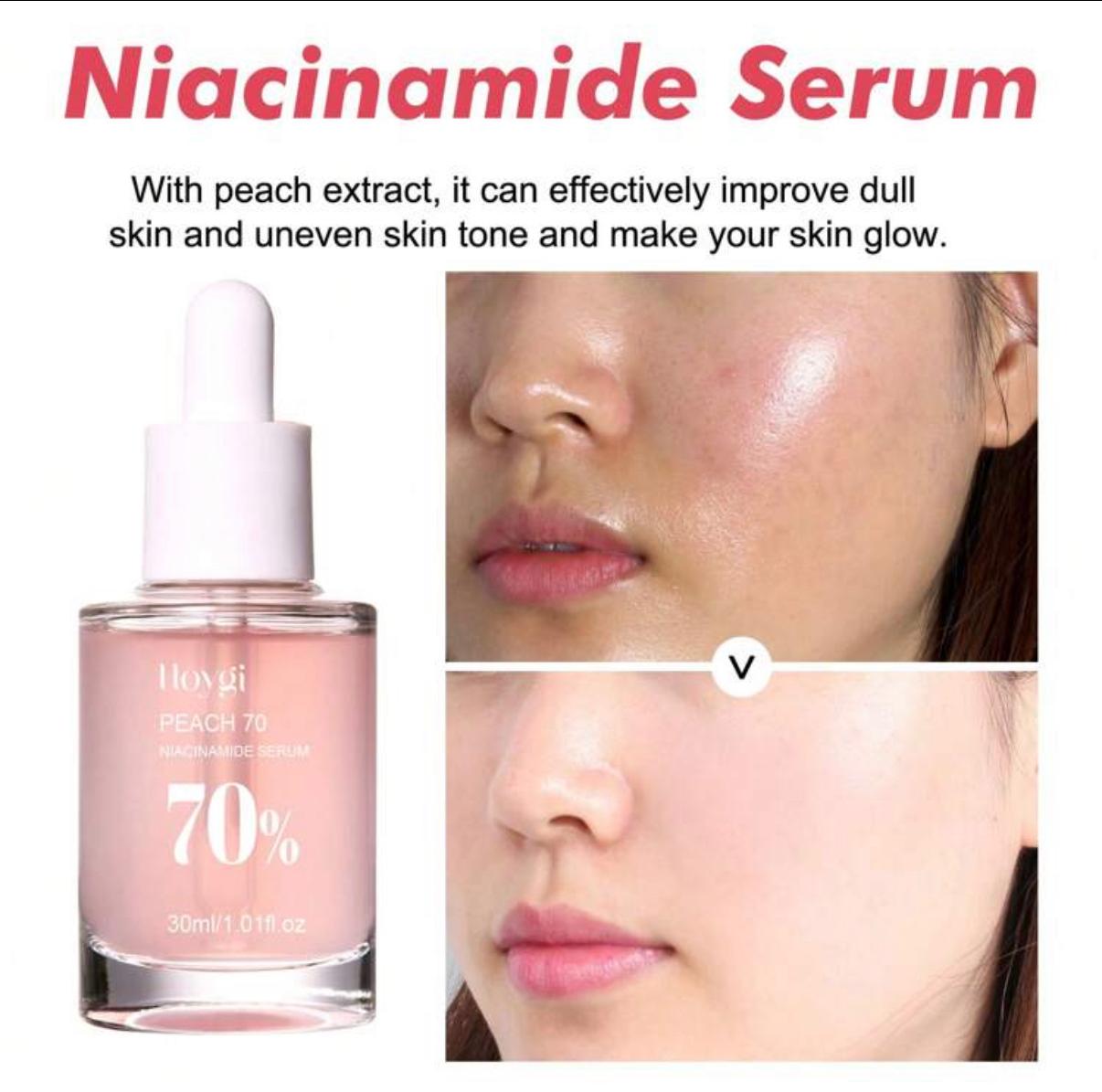 Niacinamide Serum, Brightening & Moisturizing Facial Serum 30ml