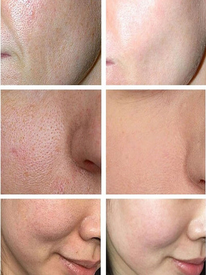 Lactobionic Acid Shrink Pores Serum Moisturizing
