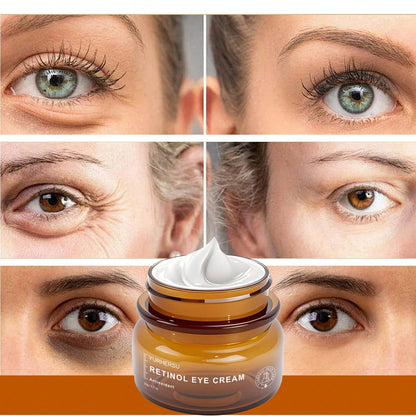 Retinol Eye Cream New Upgraded Version
