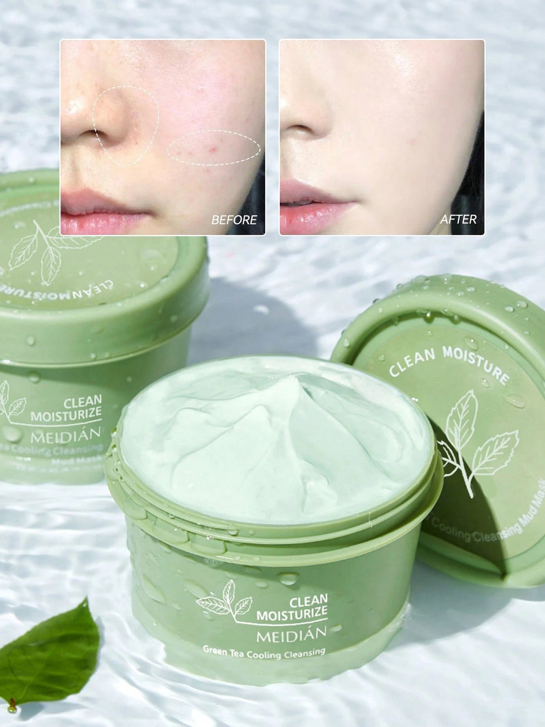 Deep Cleansing Mask, Pore Cleansing Face And Body Clay Mask