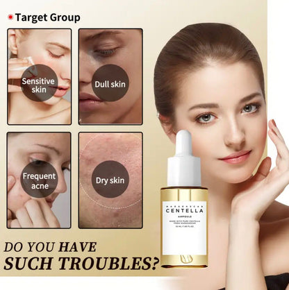 Centella Ampoule-soothing &amp; hydrating Serum for Sensitive, Acne-Prone Skin.