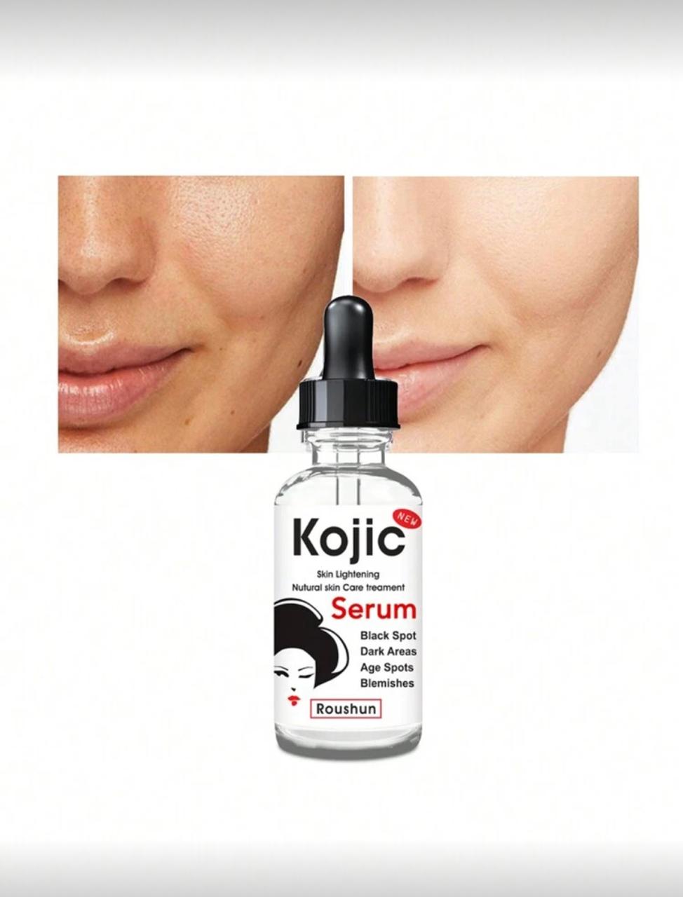 Kojic Acid Serum 30ml Whitening Firming Brightening Improving Dullness